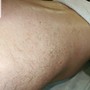 Men Brazilian/Nano needling Brojacial