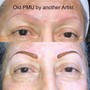 Permanent Makeup Removal