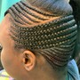 Alopecia Braiding