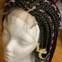 Alopecia Braiding