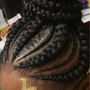 Alopecia Braiding