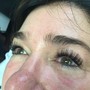 Lash Removal