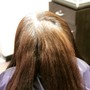 Scalp Treatment