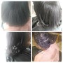 Scalp Treatment