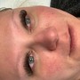 Eyelash Extension Removal