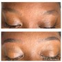 Lash Extension Removal