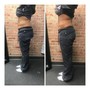 Meso Lipo injections (needless fat dissolve injections)