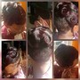 Scalp Treatment