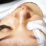 Dermaplaning