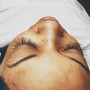 Eyelash Extension Removal