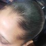 SCALP TREATMENT