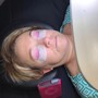 Dermaplaning