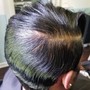 Scalp Renew Treatment