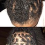 Loc ACV Treatment