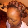 Scalp Treatment