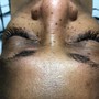 Eyelash Extension Removal