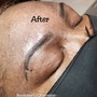 Back Facial