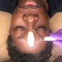 Facial Cupping