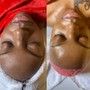 Hydro Facial+Dermaplaning