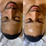 Add On Buttock Facial