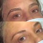 Brow Consultation