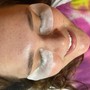 Dermaplane