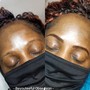 Chemical peel