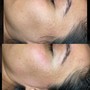 Brow Lamination