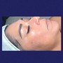 Goddess Facial. (24 K 99.9% Gold)