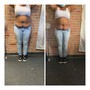 Meso Lipo injections (needless fat dissolve injections)