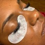 Microdermabrasion