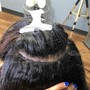 Dry Scalp Treatment