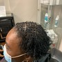 Itchy Scalp Treatment