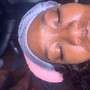 Chemical peel