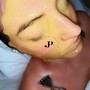 Microcurrent Facial