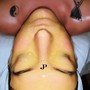 Dermaplane Skin Treatment