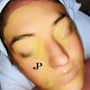 Microcurrent Facial