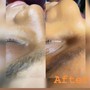 Dermaplaning Facial