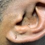 Ear Wax