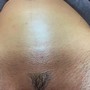 Men’s Brazilian Wax