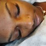 (1)Ear candling treatment