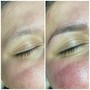 Dermablading Mini Facial