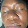 Facial  Waxing