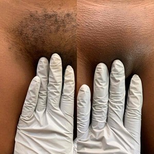 Bikini Wax Near Me San Antonio TX Appointments StyleSeat