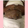 Hot Stone Back Facial