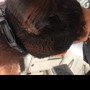 Scalp Treatment(high frequency promotes growth and kills bacteria on the scalp)