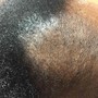 Virtual Hair Loss Consultation