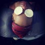 Cupping Therapy