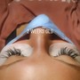 Eyelash Extension Removal