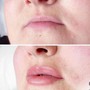 4-6 Week Lip Blush Touch Ups